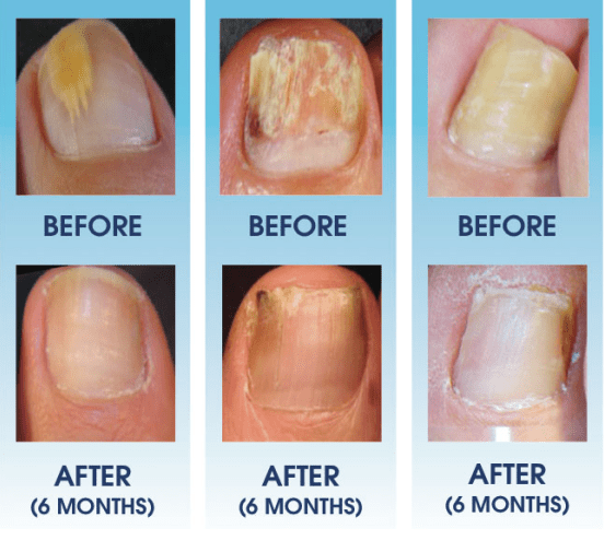 {xunruicms_img_title} {xunruicms_img_title}