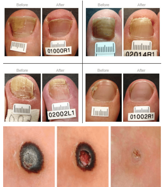 {xunruicms_img_title} {xunruicms_img_title}